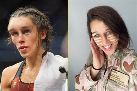 UFC Star Joanna Jedrzejczyk Plastic Surgery